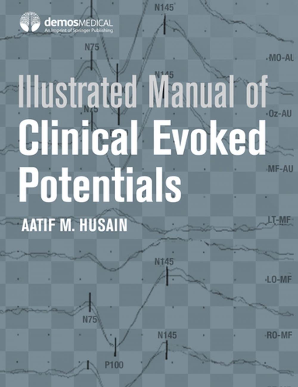 Big bigCover of Illustrated Manual of Clinical Evoked Potentials