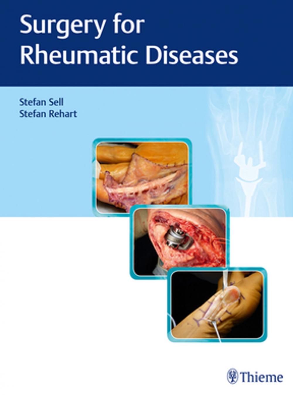 Big bigCover of Surgery for Rheumatic Diseases