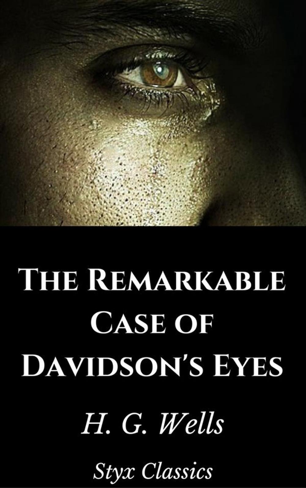 Big bigCover of The Remarkable Case of Davidson's Eyes