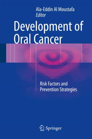 bigCover of the book Development of Oral Cancer by 
