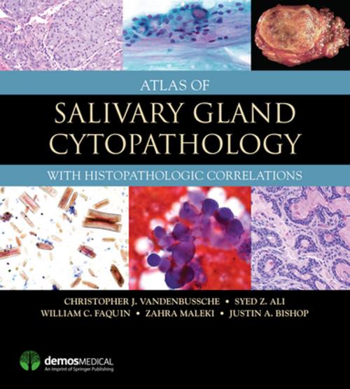 Cover of the book Atlas of Salivary Gland Cytopathology by Christopher J. VandenBussche, MD, PhD, Syed Z. Ali, MD, FRCPath, FIAC, William C. Faquin, MD, PhD, Zahra Maleki, MD, Justin Bishop, MD, Springer Publishing Company