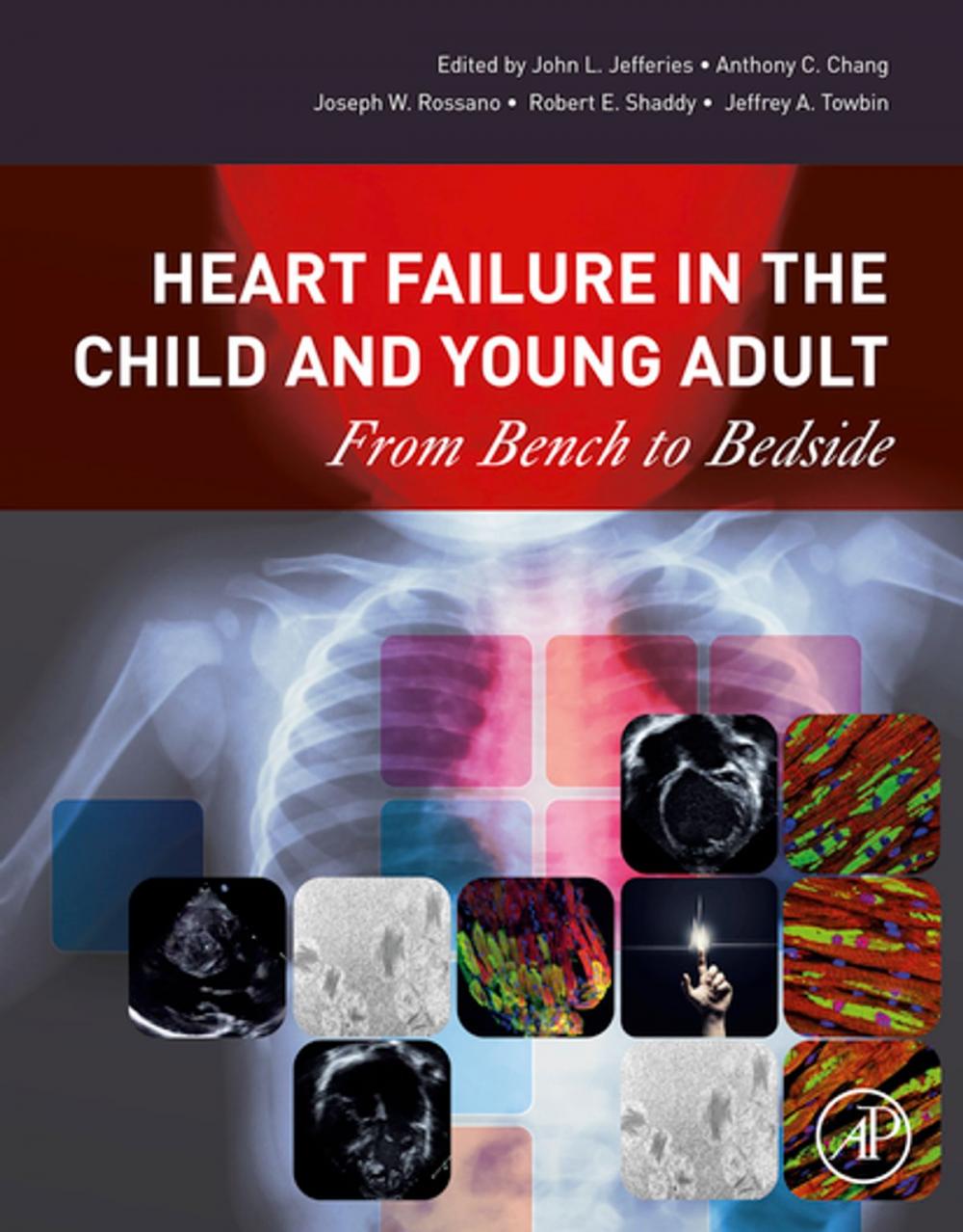 Big bigCover of Heart Failure in the Child and Young Adult