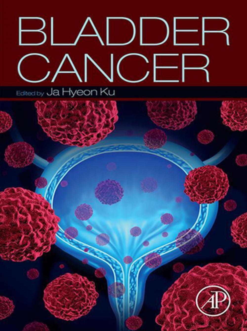 Big bigCover of Bladder Cancer