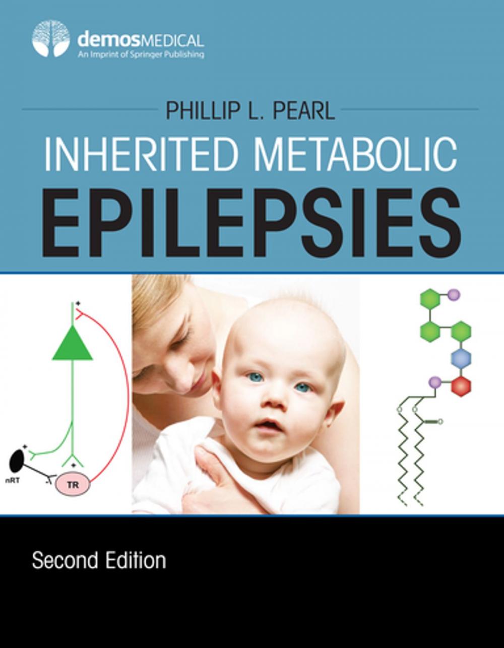 Big bigCover of Inherited Metabolic Epilepsies