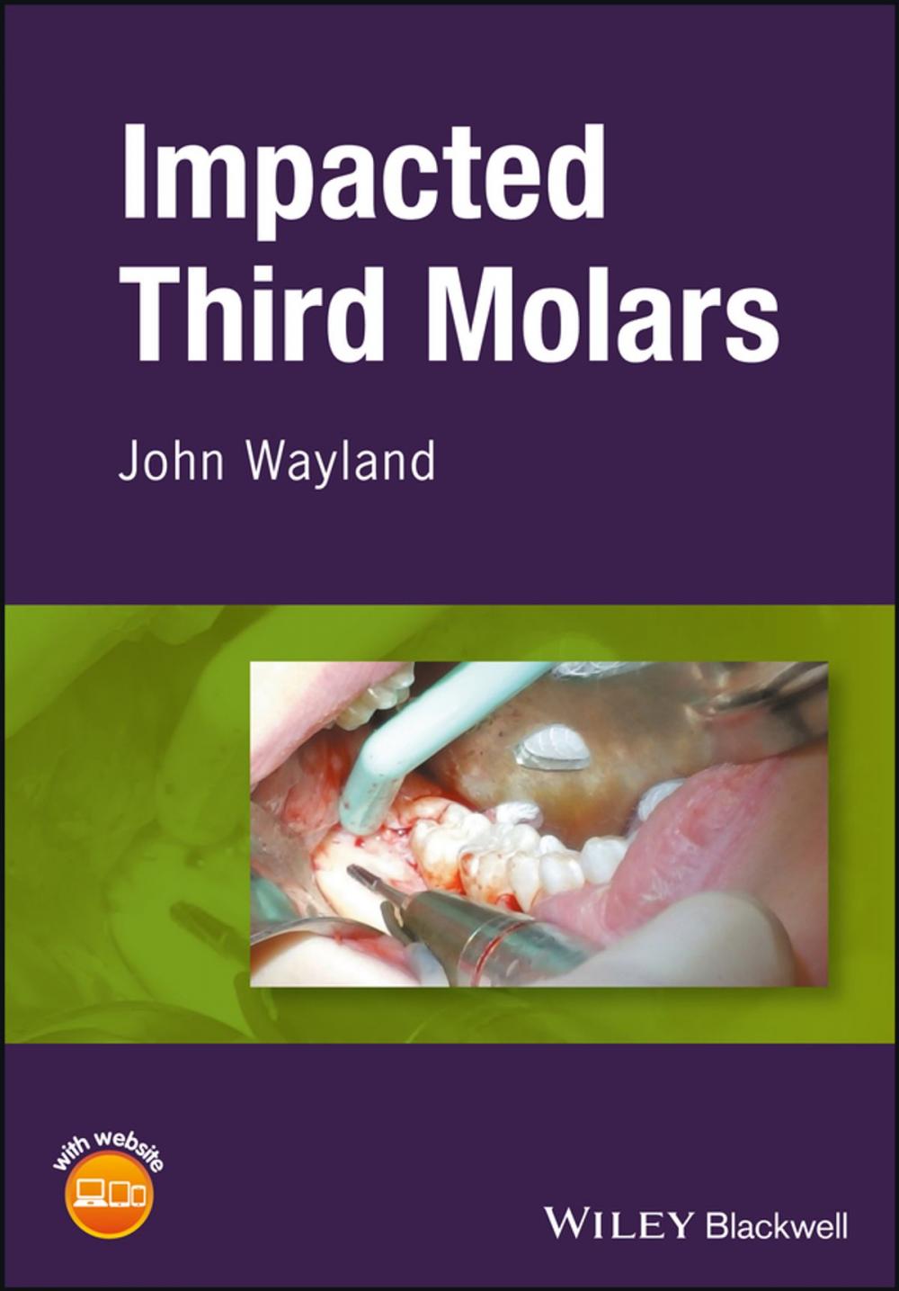 Big bigCover of Impacted Third Molars