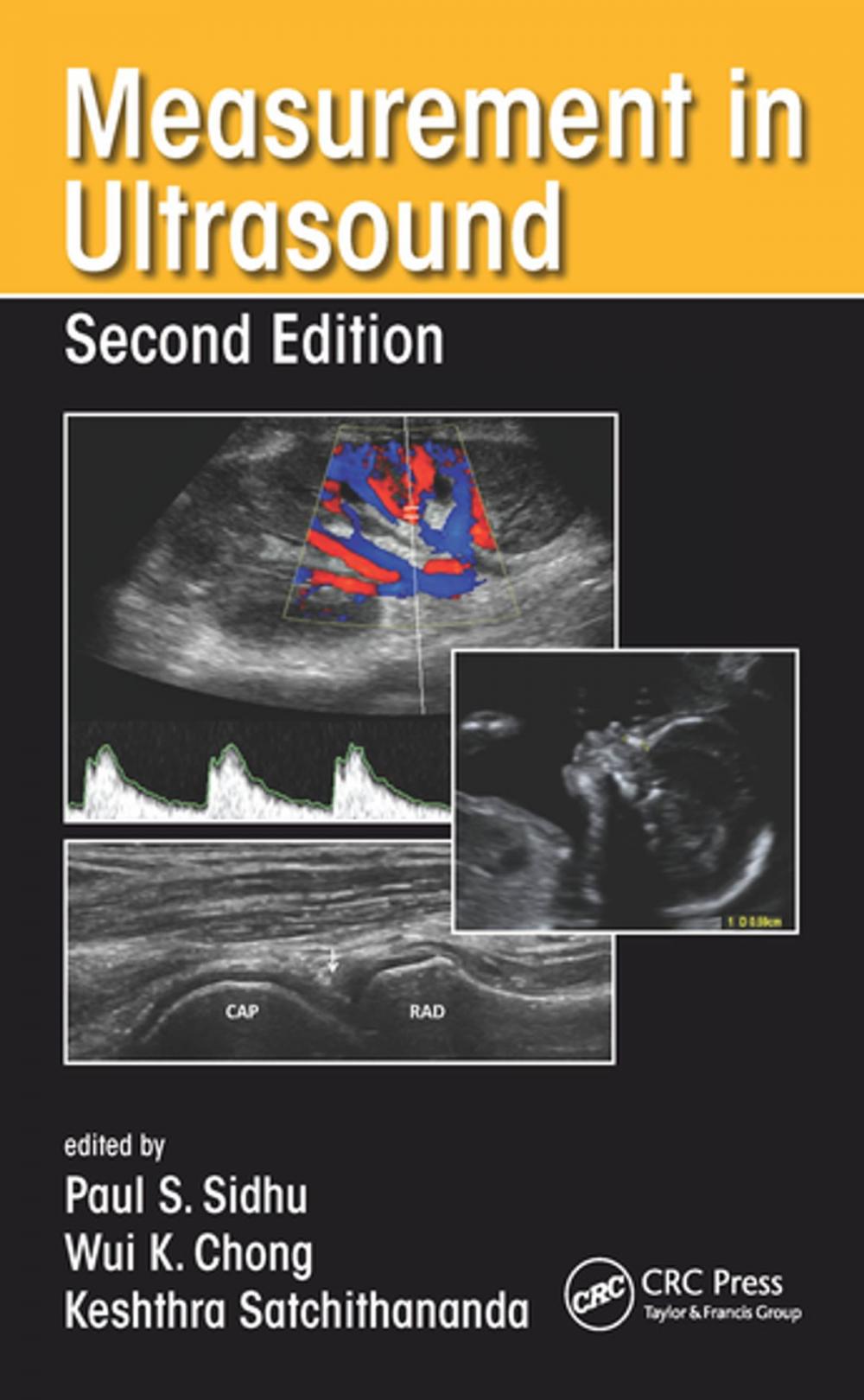 Big bigCover of Measurement in Ultrasound