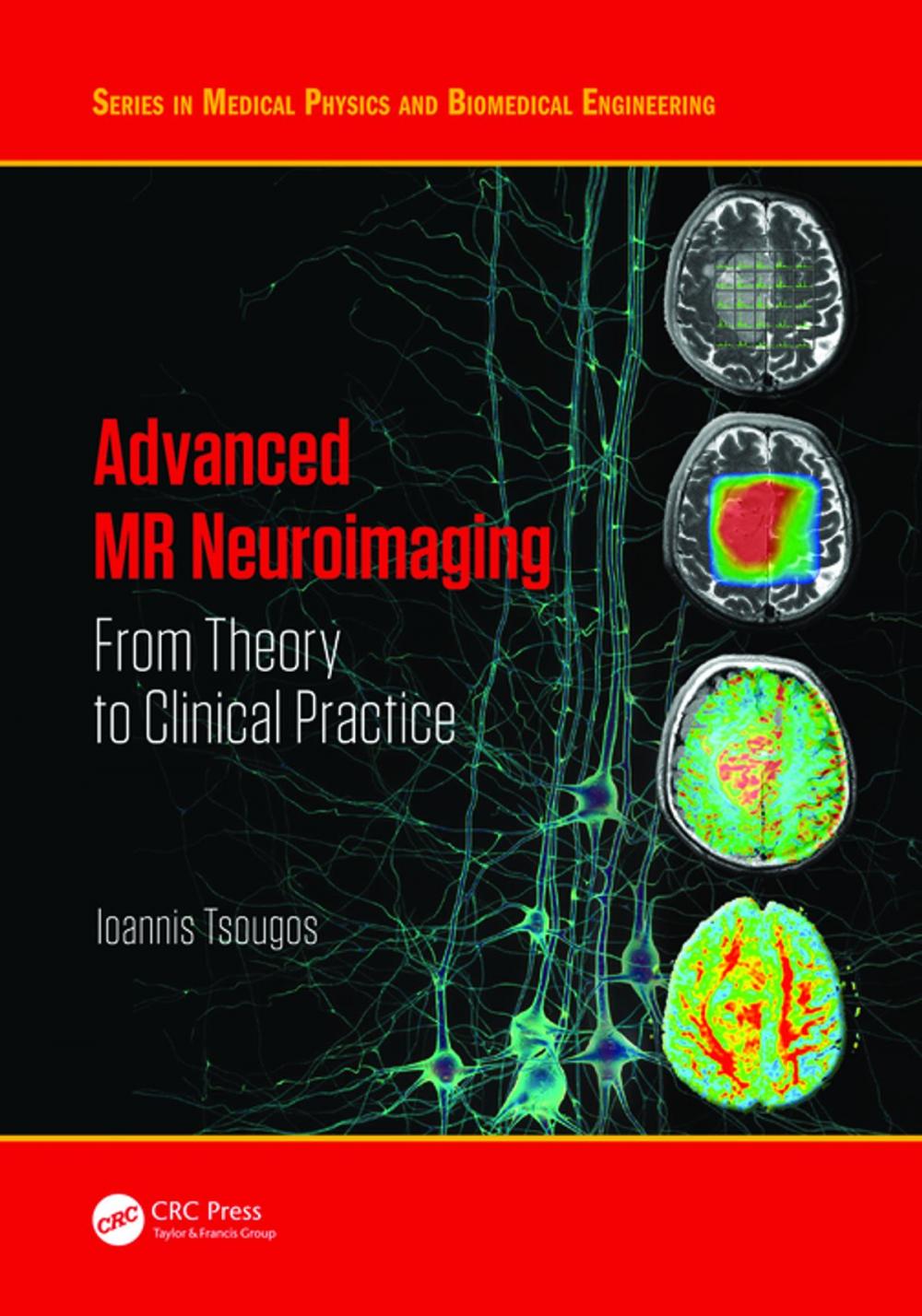 Big bigCover of Advanced MR Neuroimaging