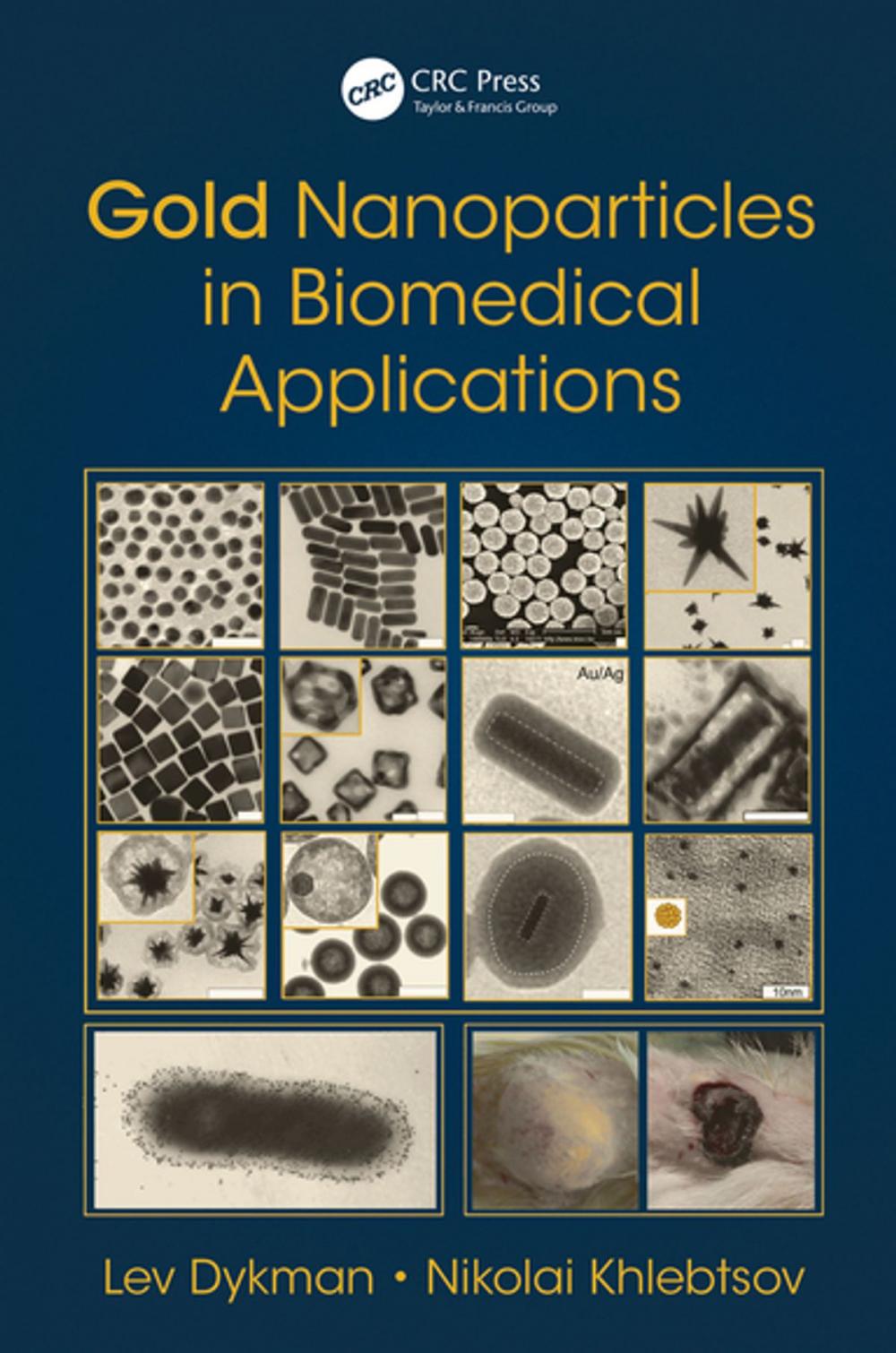 Big bigCover of Gold Nanoparticles in Biomedical Applications