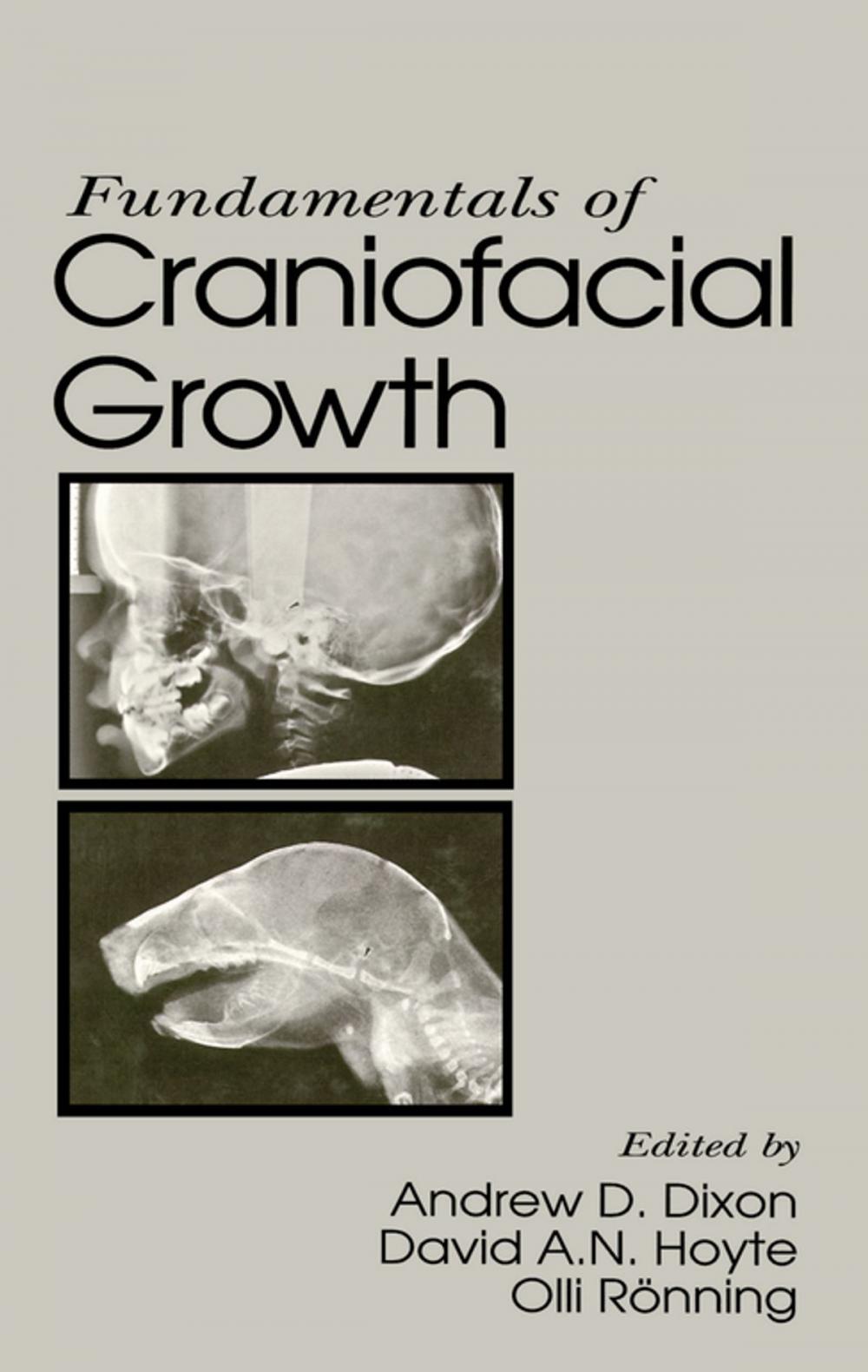 Big bigCover of Fundamentals of Craniofacial Growth