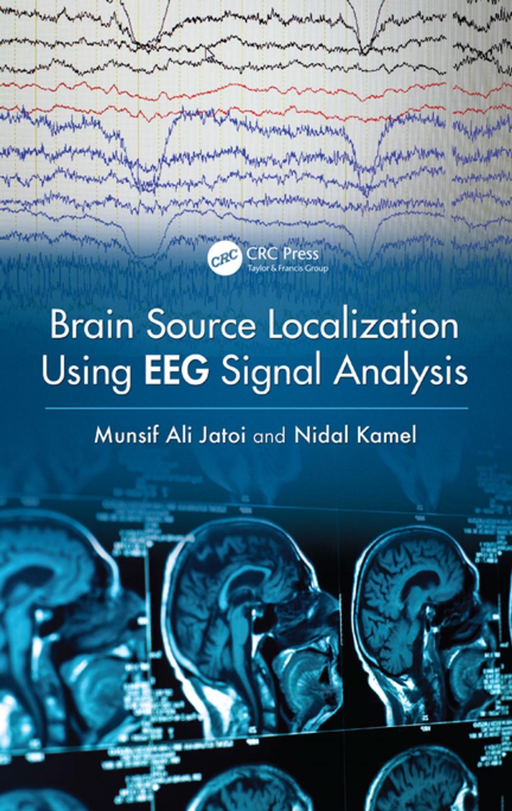 Big bigCover of Brain Source Localization Using EEG Signal Analysis