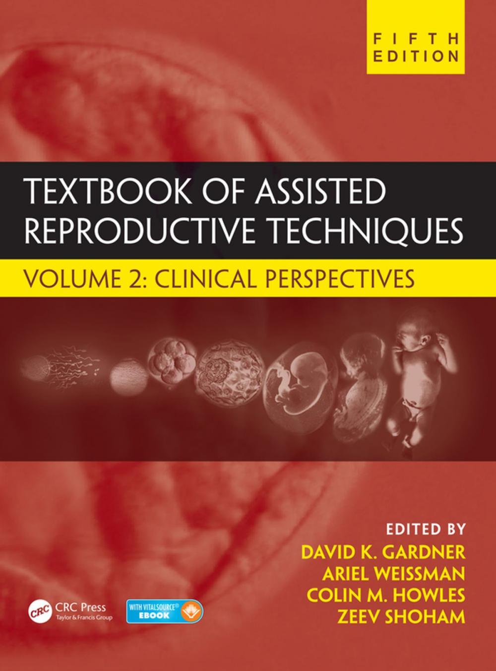 Big bigCover of Textbook of Assisted Reproductive Techniques