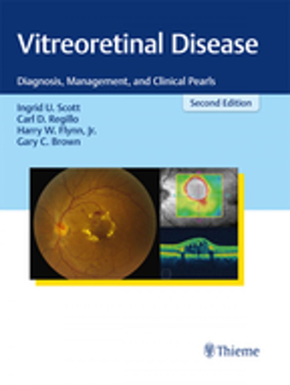 Big bigCover of Vitreoretinal Disease