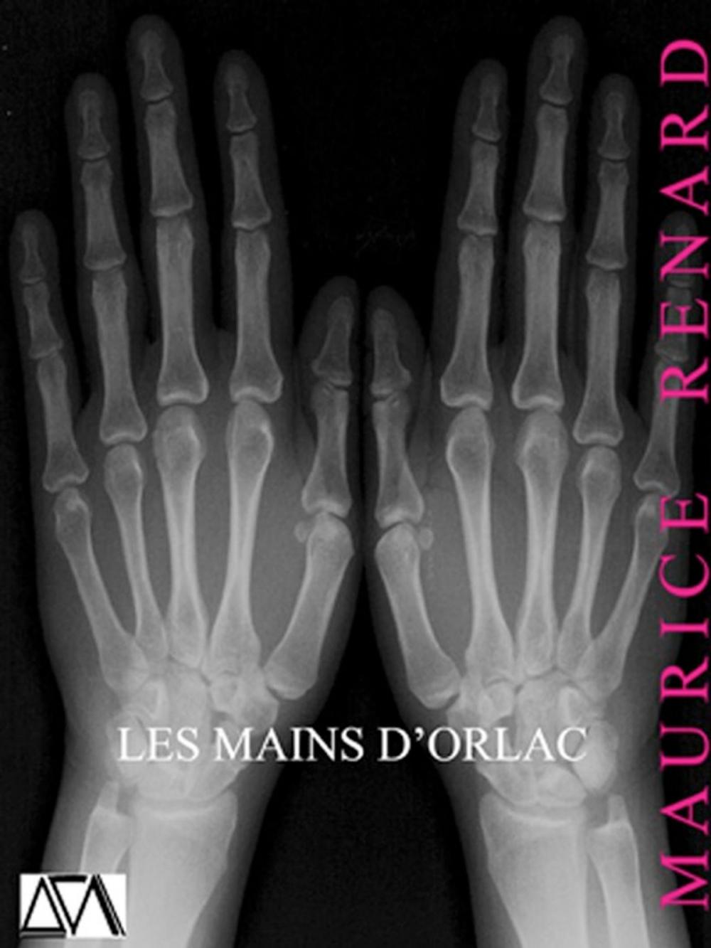 Big bigCover of Les Mains d'Orlac