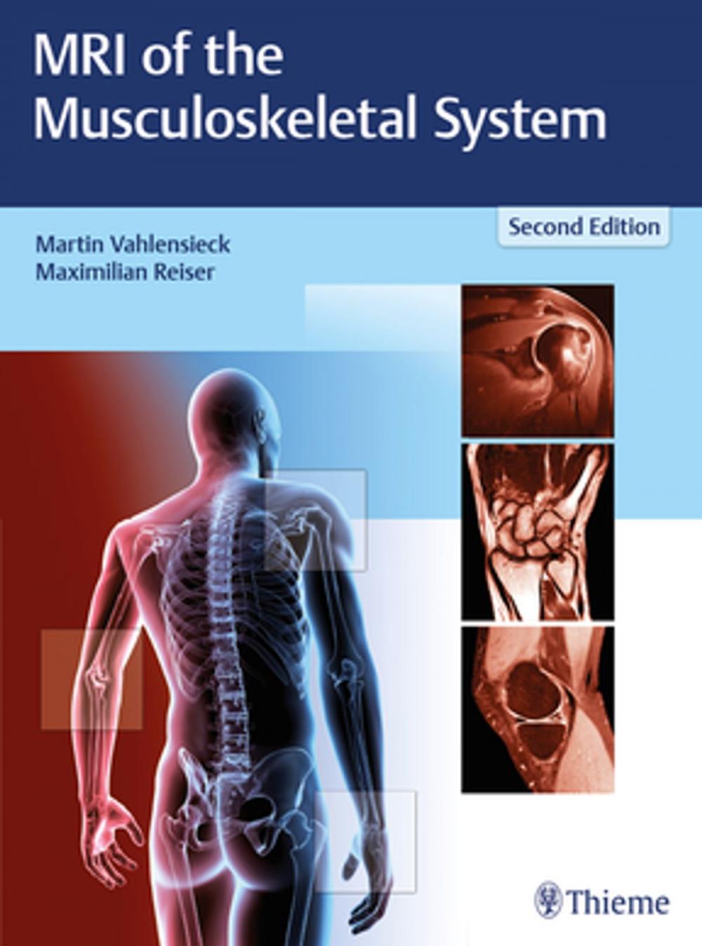 Big bigCover of MRI of the Musculoskeletal System