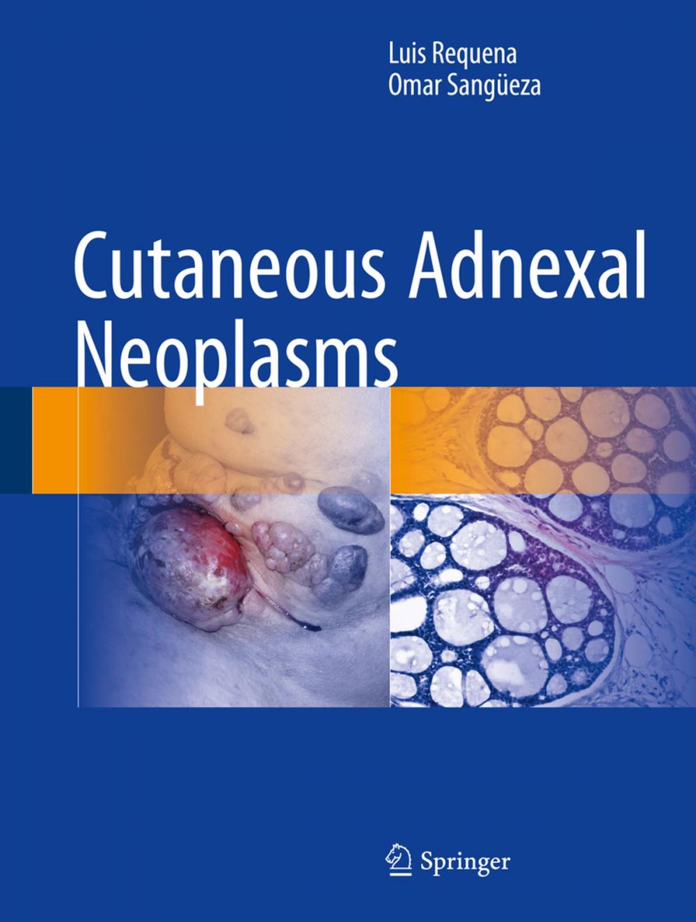 Big bigCover of Cutaneous Adnexal Neoplasms