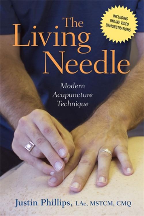 Cover of the book The Living Needle by Justin Phillips, Jessica Kingsley Publishers