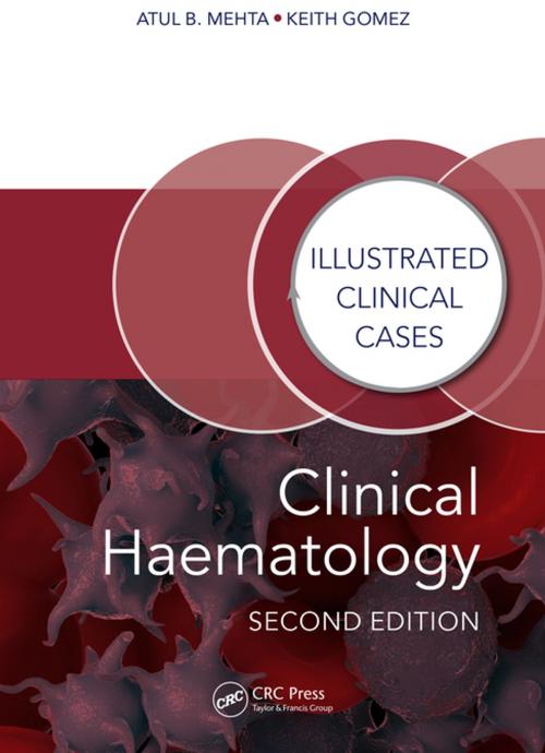 Cover of the book Clinical Haematology by Atul Bhanu Mehta, Keith Gomez, CRC Press