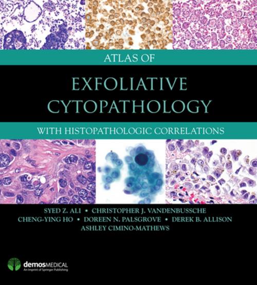 Cover of the book Atlas of Exfoliative Cytopathology by Syed Z. Ali, MD, FRCPath, FIAC, Christopher J. VandenBussche, MD, PhD, Cheng-Ying Ho, MD, PhD, Doreen N. Palsgrove, MD, Derek Allison, MD, Ashley Cimino-Mathews, MD, Springer Publishing Company