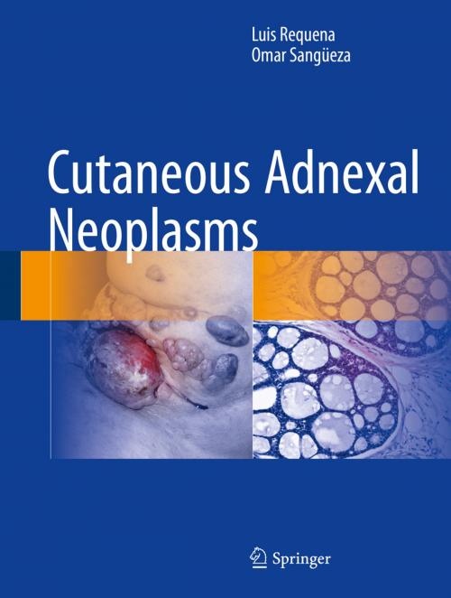 Cover of the book Cutaneous Adnexal Neoplasms by Luis Requena, Omar Sangüeza, Springer International Publishing