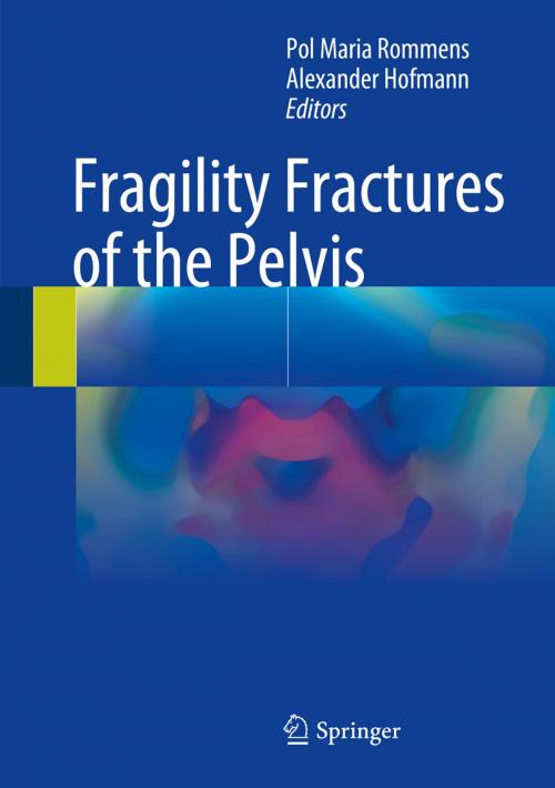 Cover of the book Fragility Fractures of the Pelvis by , Springer International Publishing