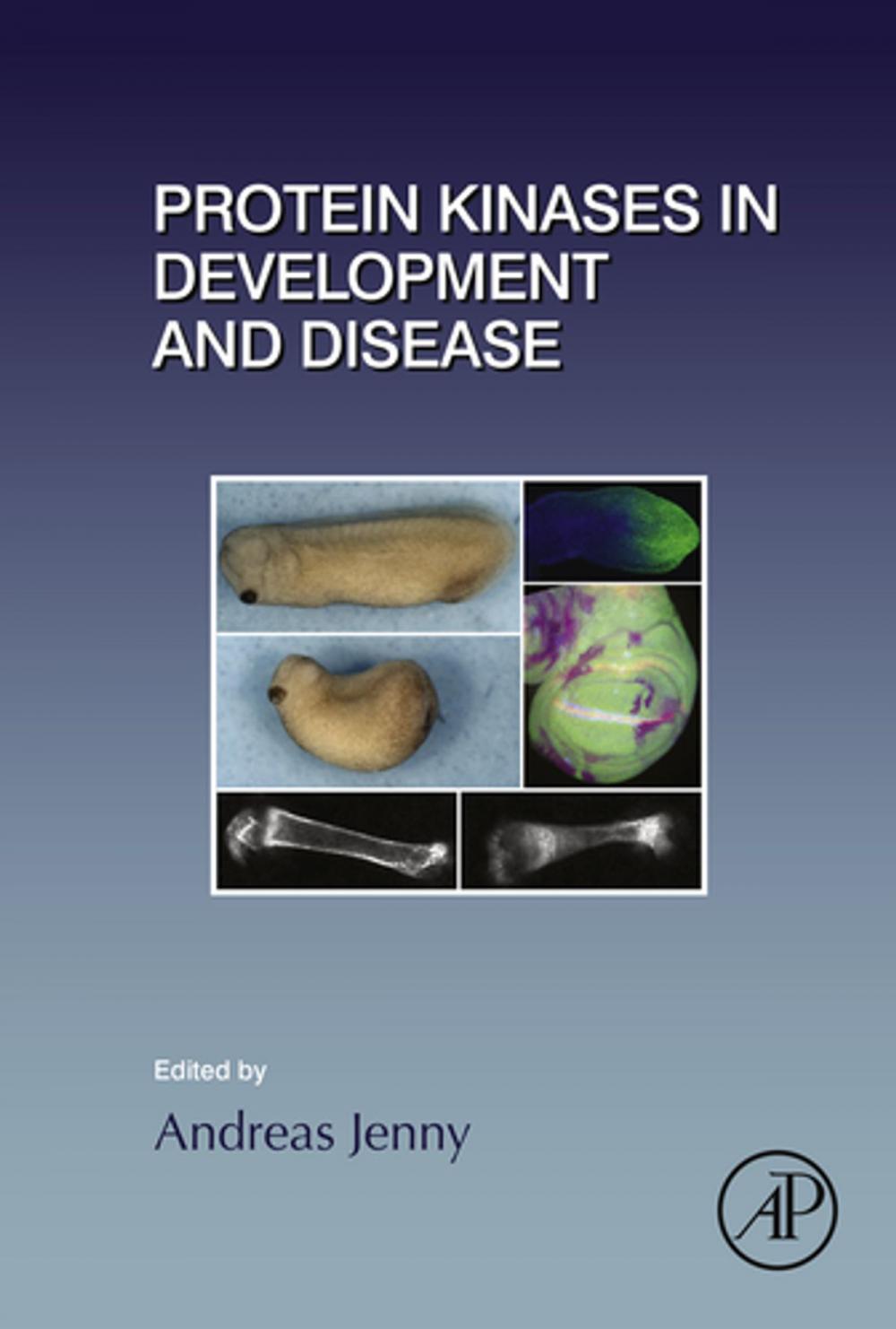 Big bigCover of Protein Kinases in Development and Disease