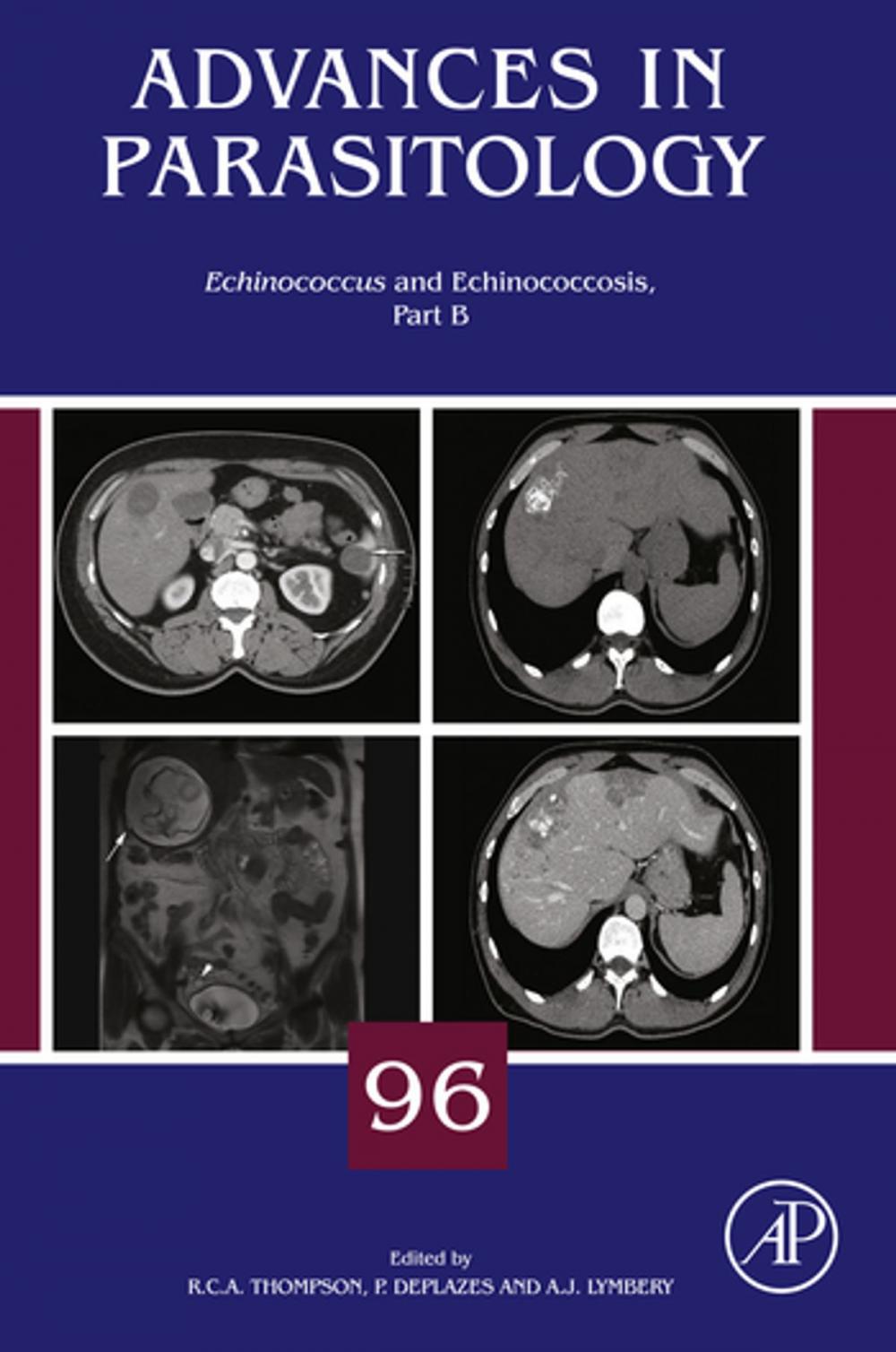 Big bigCover of Echinococcus and Echinococcosis, Part B