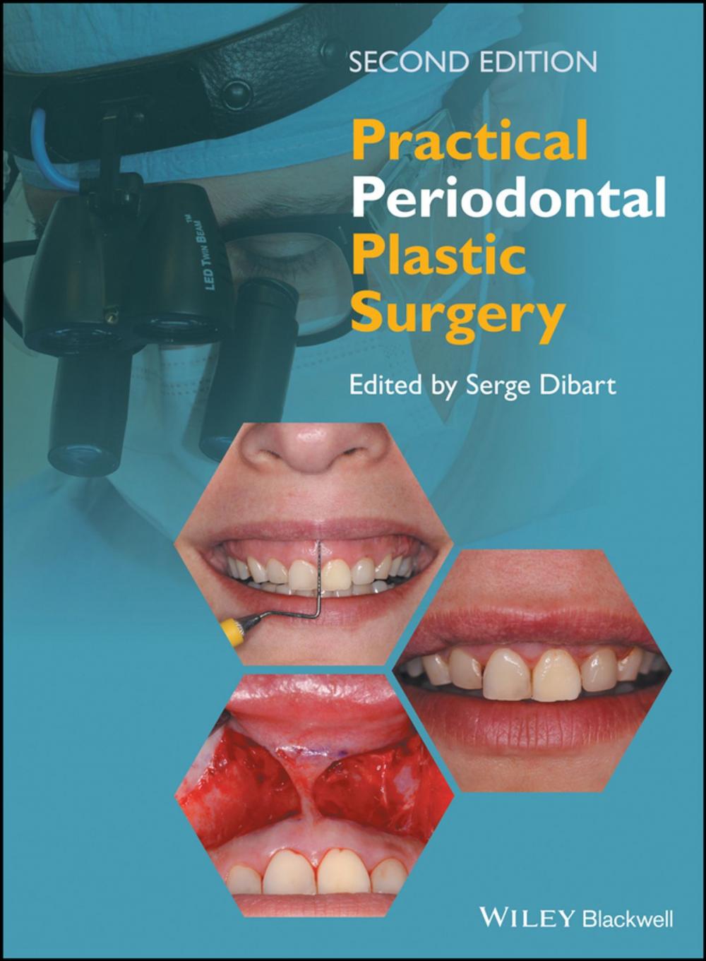 Big bigCover of Practical Periodontal Plastic Surgery