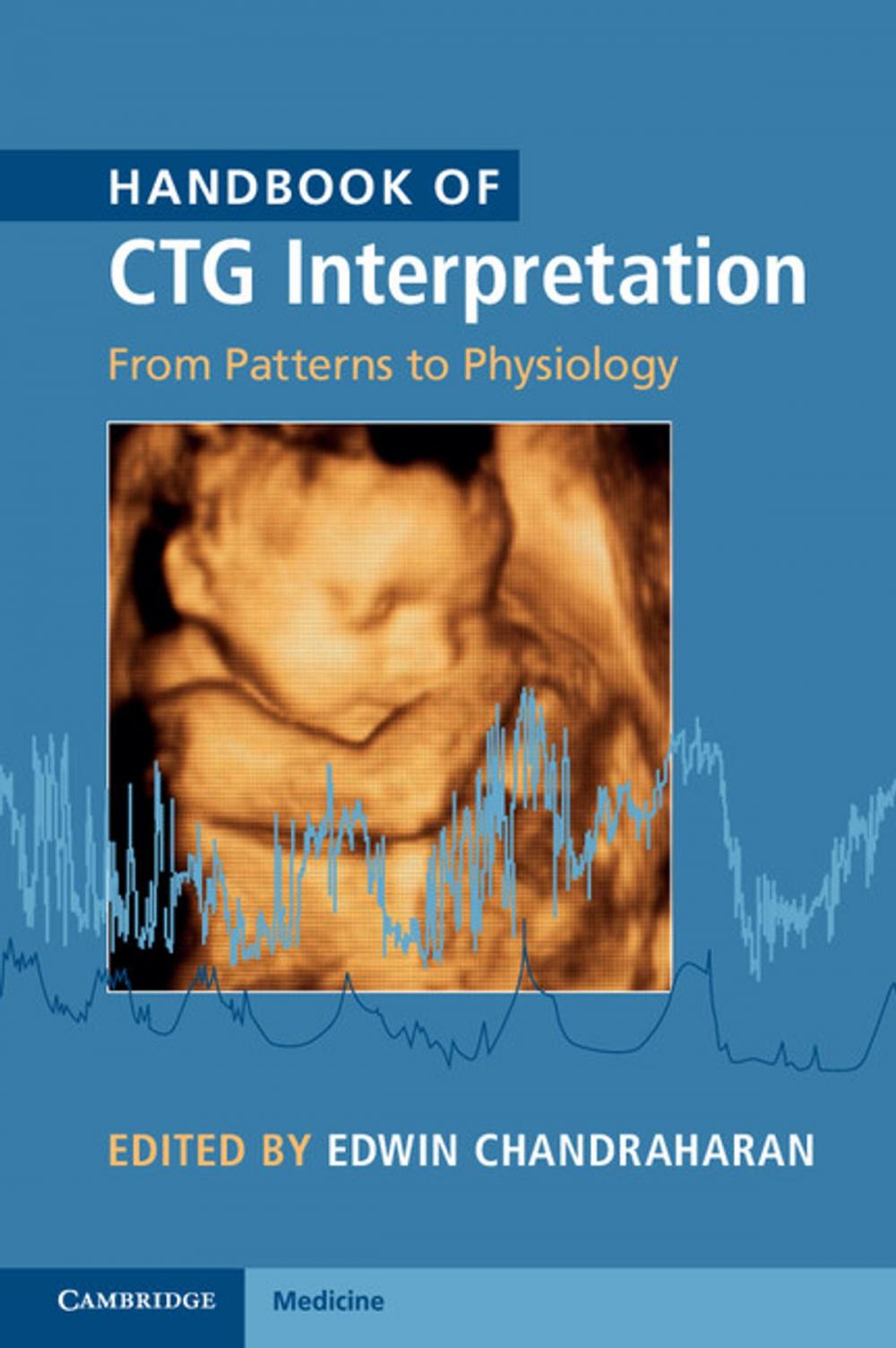 Big bigCover of Handbook of CTG Interpretation