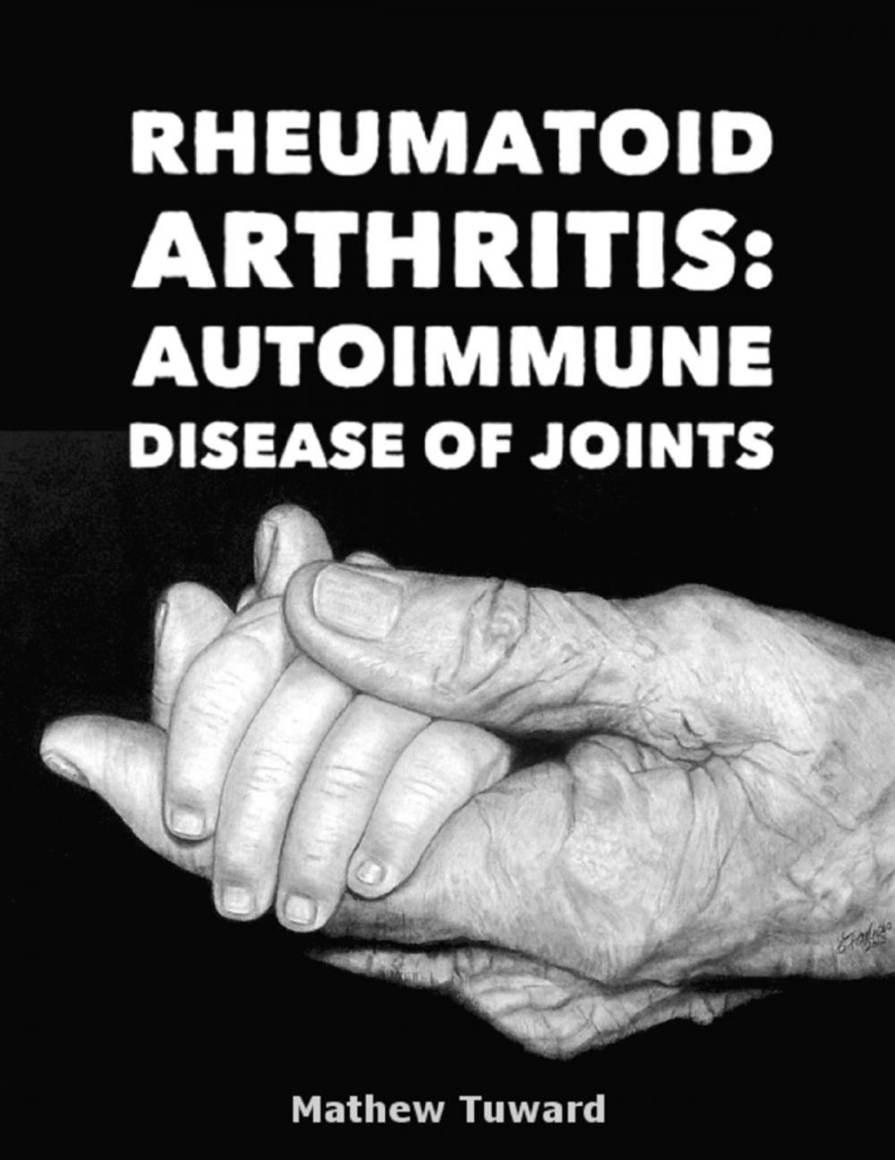 Big bigCover of Rheumatoid Arthritis: Autoimmune Disease of Joints