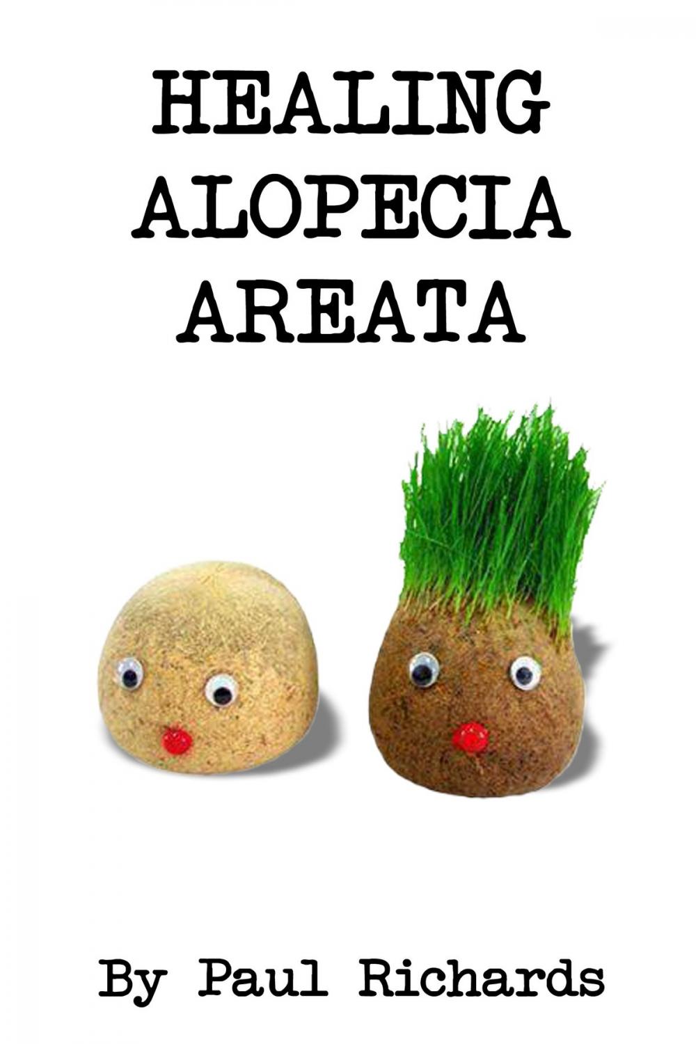 Big bigCover of Healing Alopecia Areata