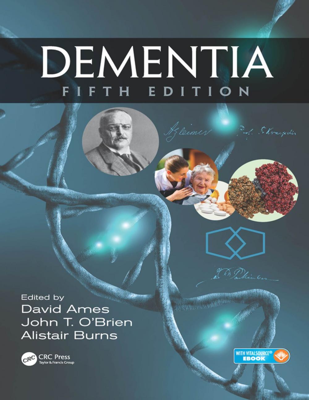 Big bigCover of Dementia