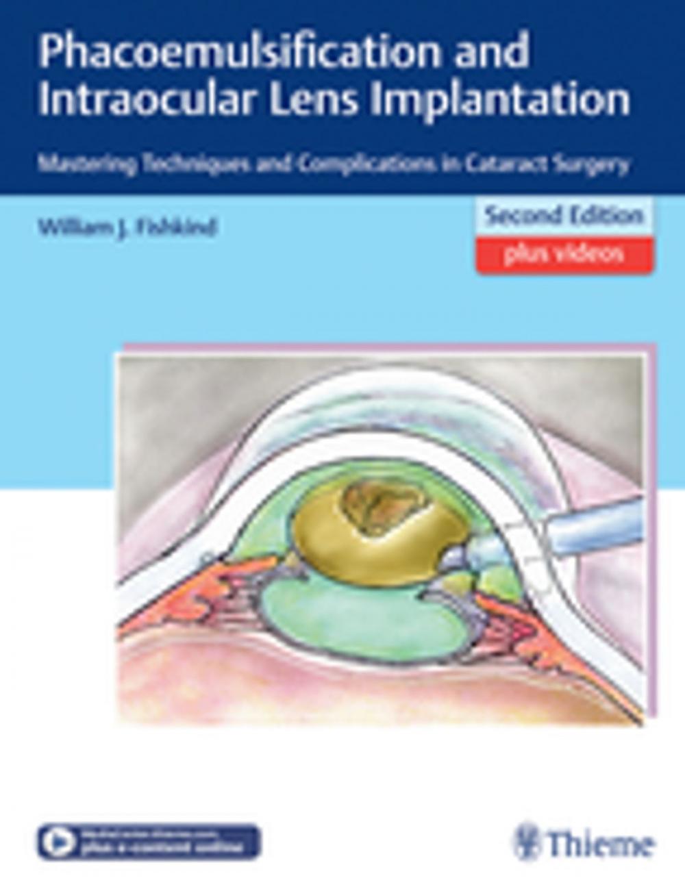 Big bigCover of Phacoemulsification and Intraocular Lens Implantation