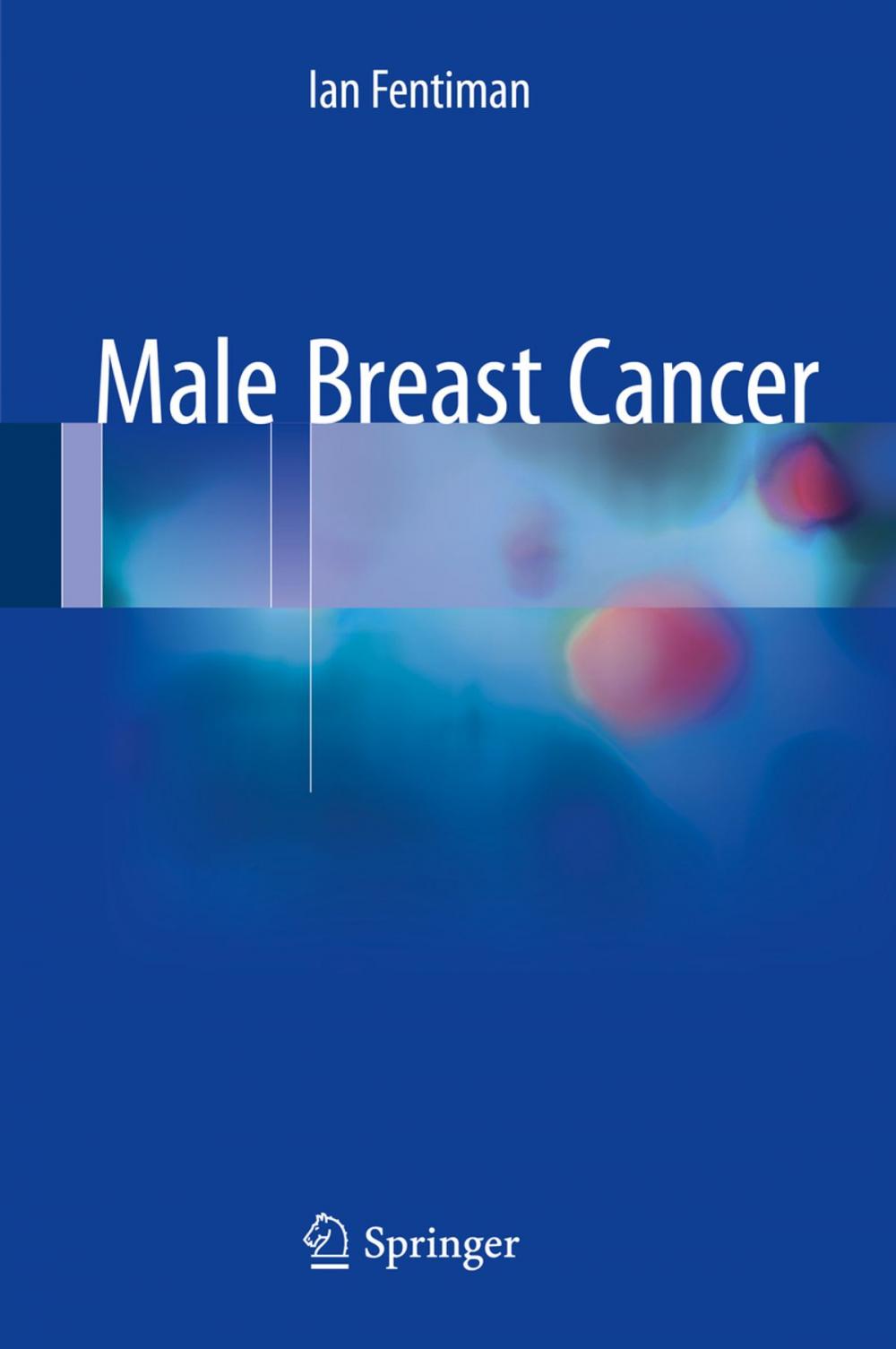 Big bigCover of Male Breast Cancer