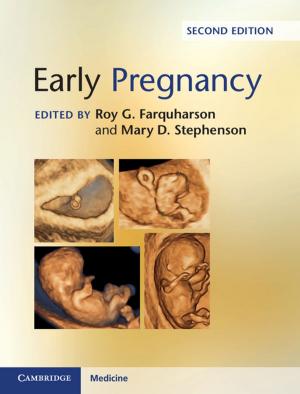 Cover of the book Early Pregnancy by Yishai Kiel