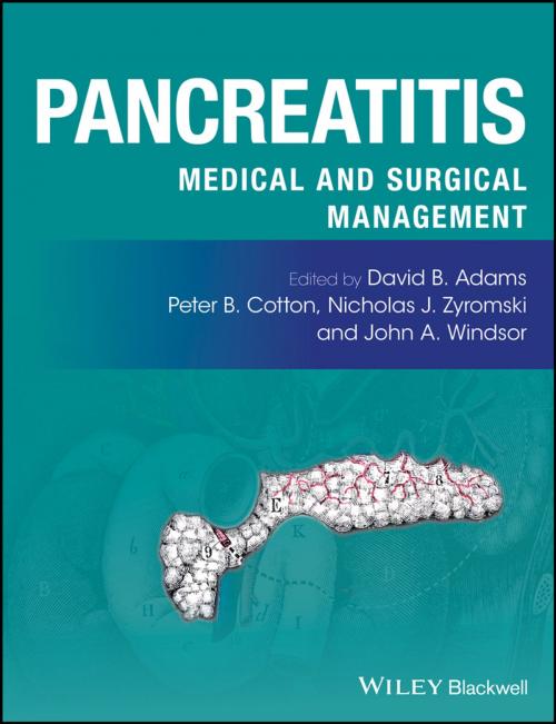 Cover of the book Pancreatitis by , Wiley