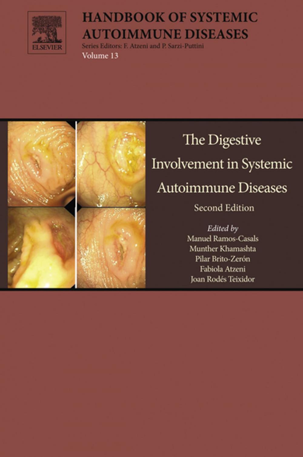 Big bigCover of The Digestive Involvement in Systemic Autoimmune Diseases