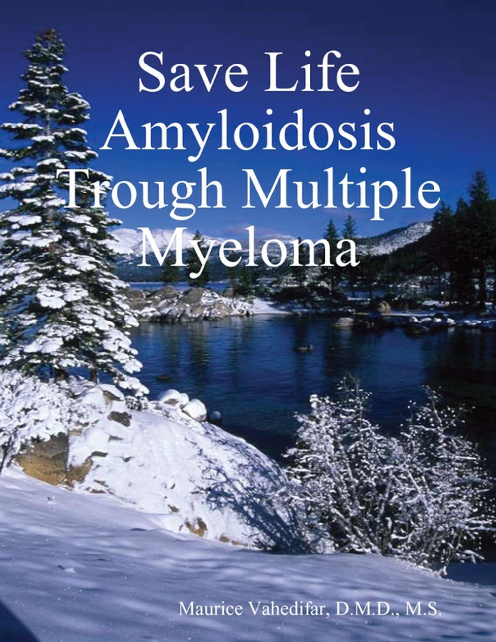 Big bigCover of Save Life Amyloidosis Trough Multiple Myeloma