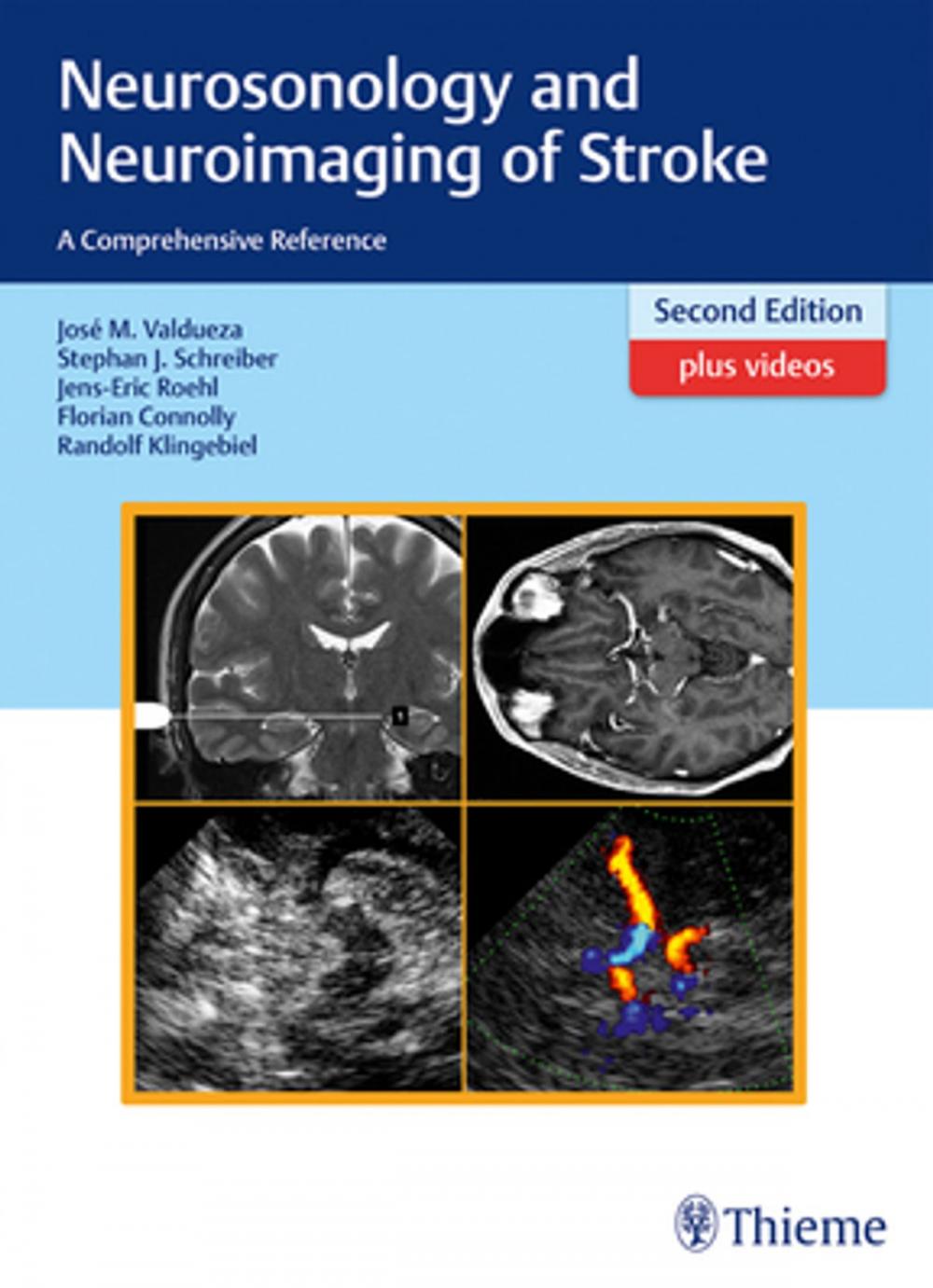 Big bigCover of Neurosonology and Neuroimaging of Stroke