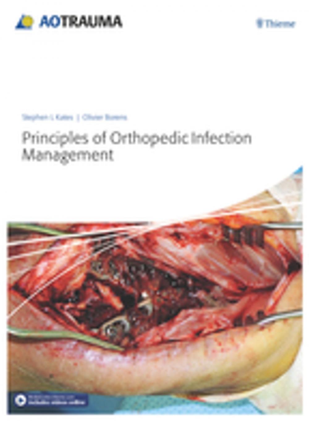 Big bigCover of Principles of Orthopedic Infection Management