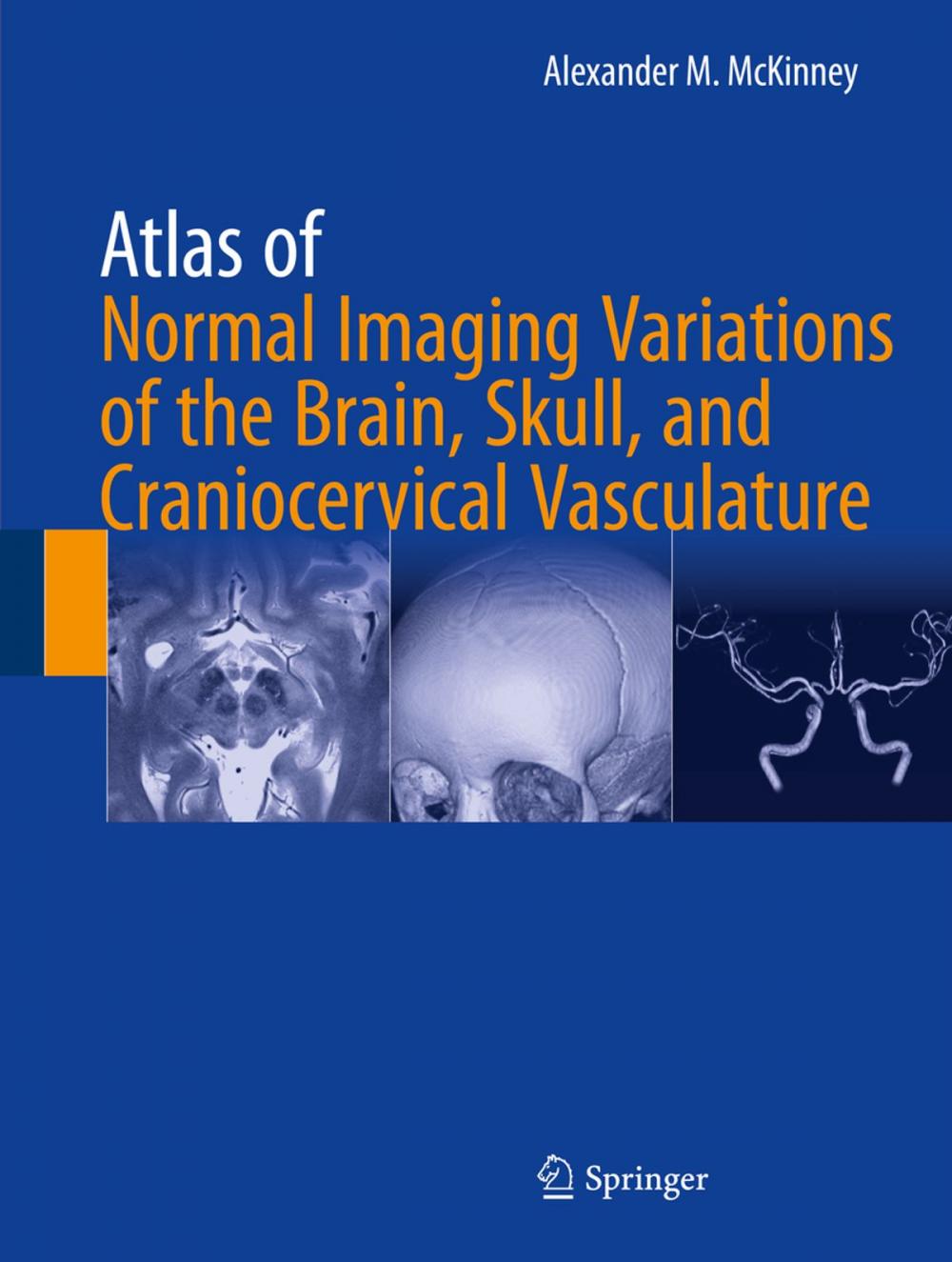 Big bigCover of Atlas of Normal Imaging Variations of the Brain, Skull, and Craniocervical Vasculature