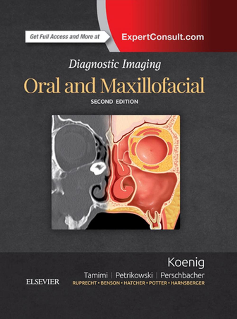Big bigCover of Diagnostic Imaging: Oral and Maxillofacial E-Book