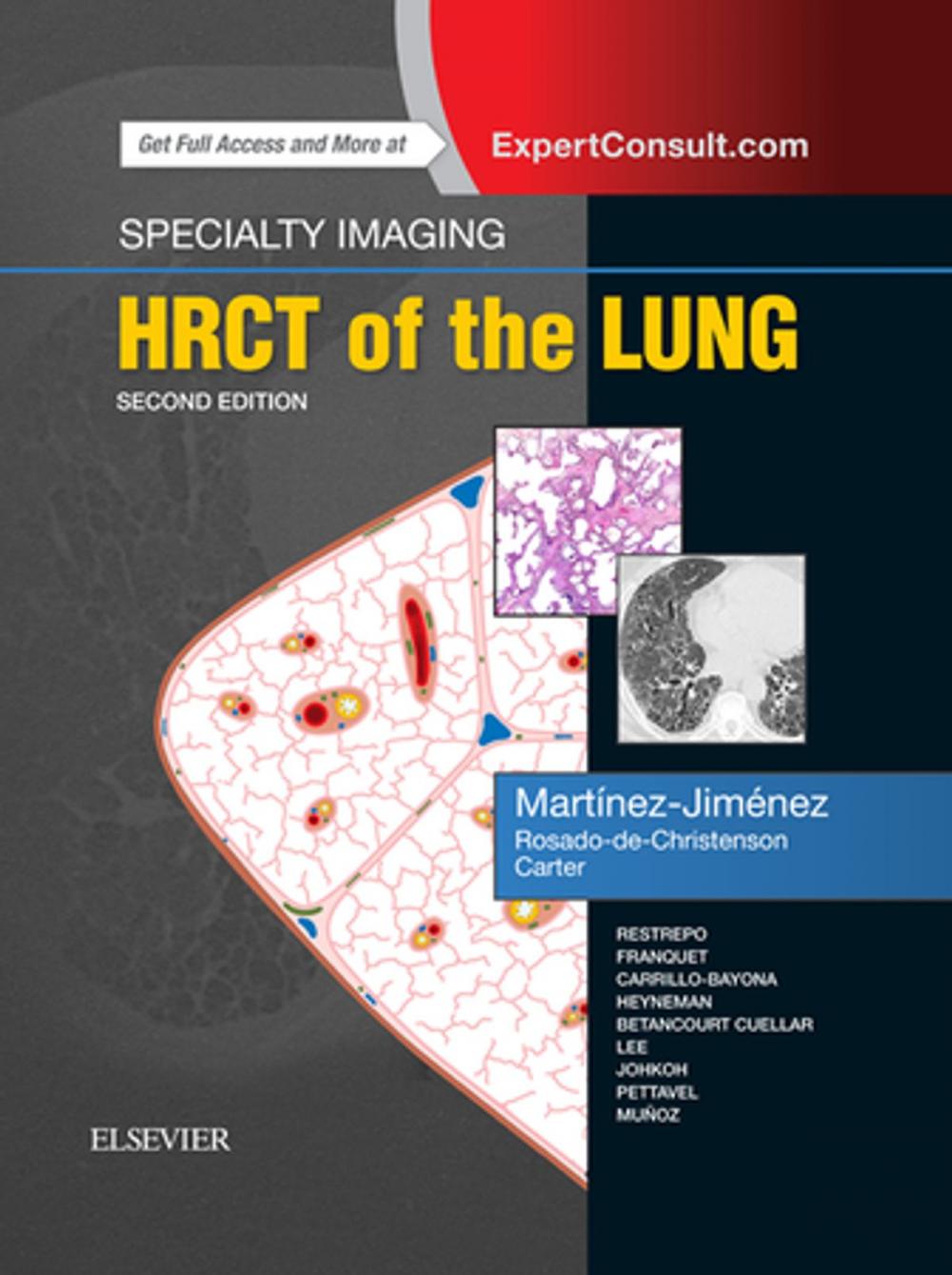 Big bigCover of Specialty Imaging: HRCT of the Lung E-Book