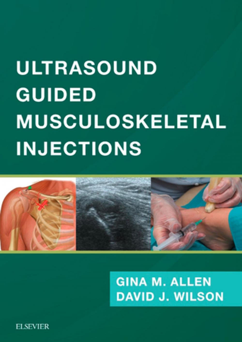 Big bigCover of Ultrasound Guided Musculoskeletal Injections E-Book