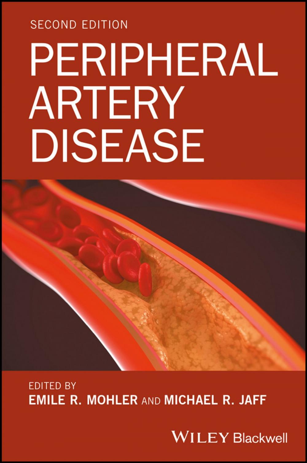 Big bigCover of Peripheral Artery Disease