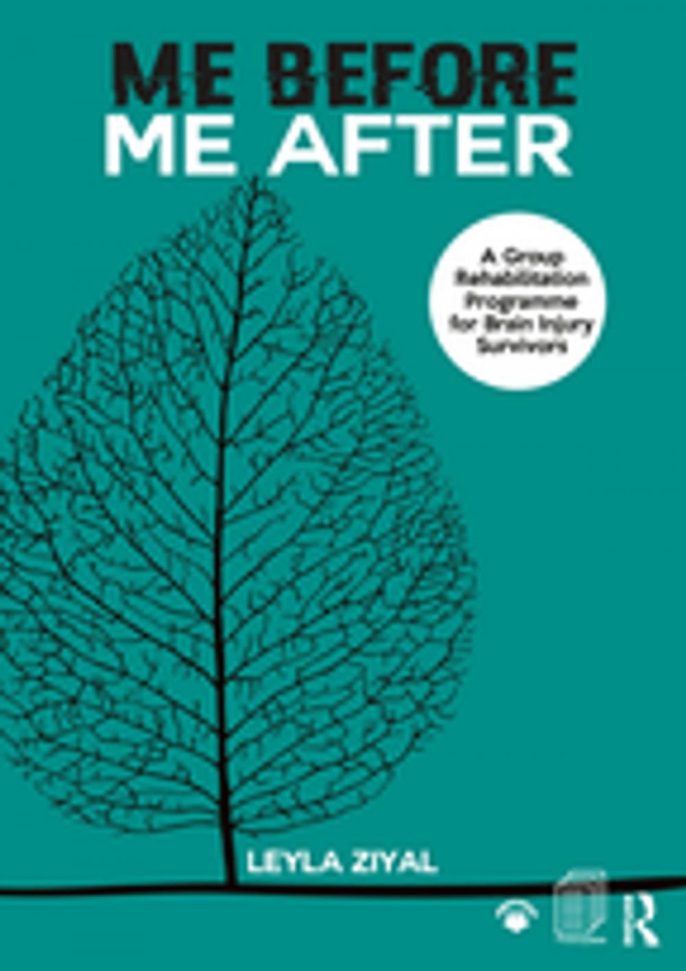 Big bigCover of Me Before/ Me After