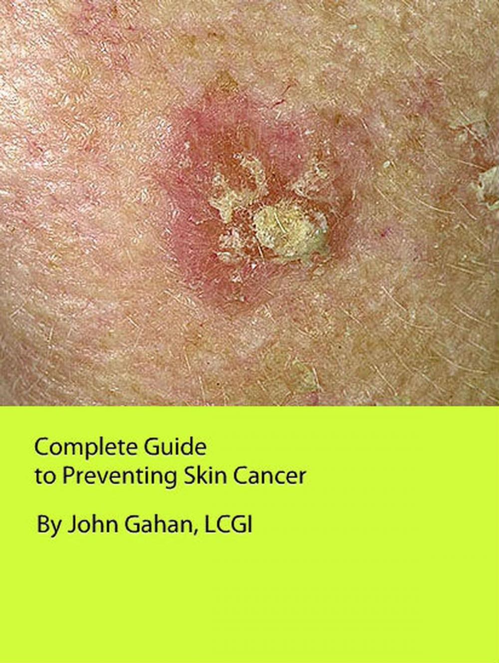 Big bigCover of Complete Guide to Preventing Skin Cancer