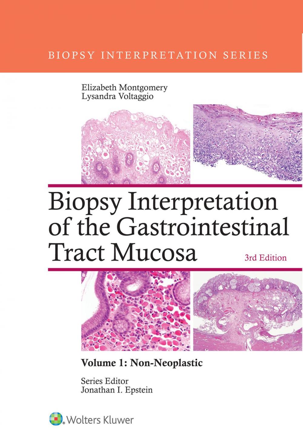 Big bigCover of Biopsy Interpretation of the Gastrointestinal Tract Mucosa: Volume 1: Non-Neoplastic