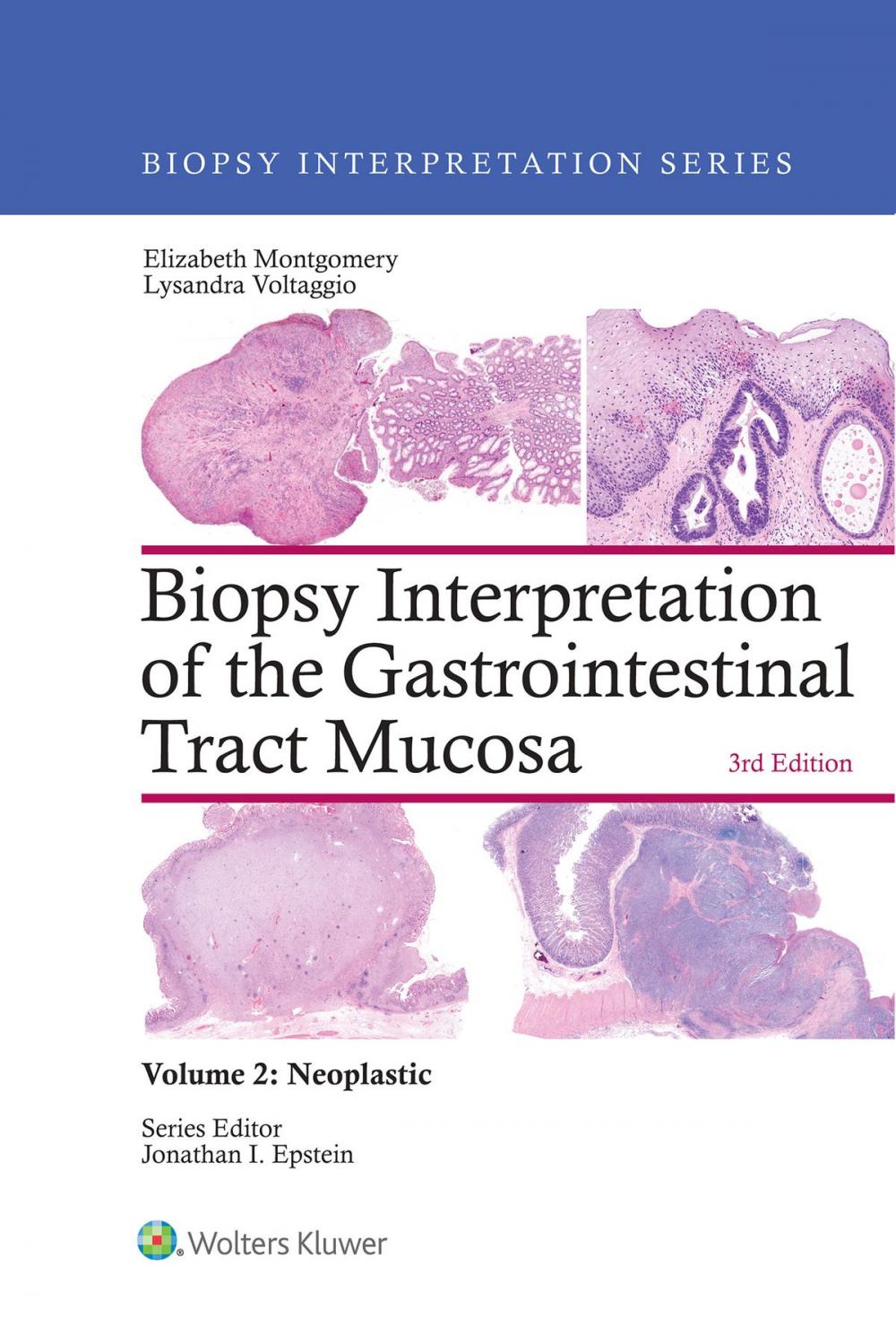 Big bigCover of Biopsy Interpretation of the Gastrointestinal Tract Mucosa: Volume 2: Neoplastic