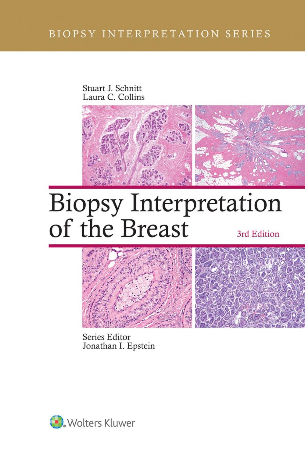 Big bigCover of Biopsy Interpretation of the Breast