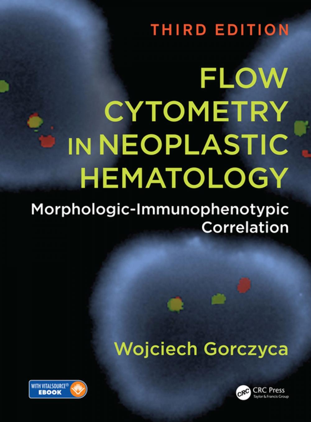 Big bigCover of Flow Cytometry in Neoplastic Hematology